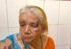 ईंट के विवाद में दबंगों ने महिला सहित दो पर किया हमला, लगी गंभीर चोट, मुकदमा दर्ज